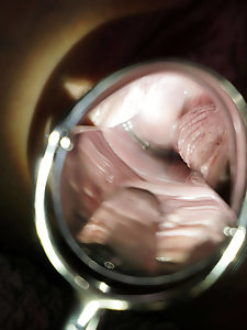 Kathai relax In The Spa